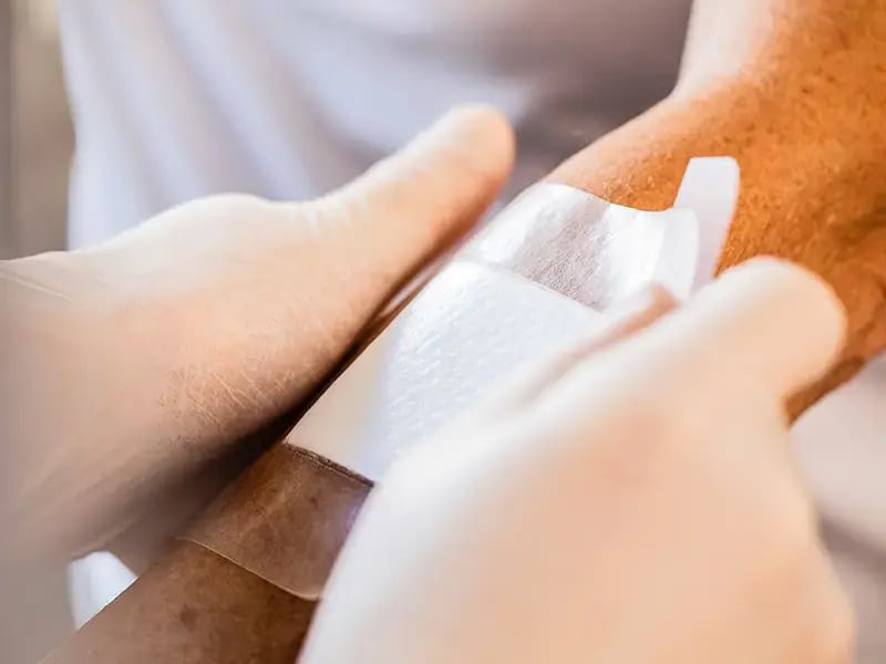 Nahaufnahme Versorgung einer Wunde